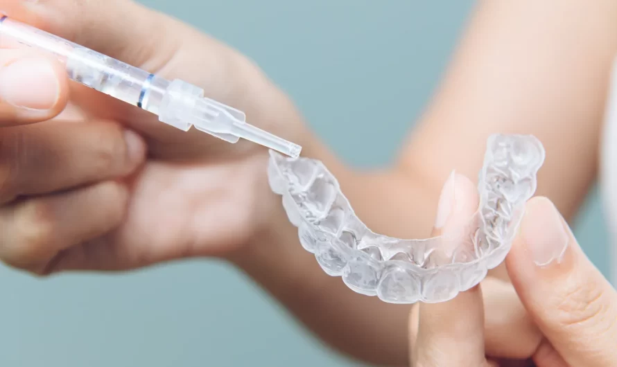 Invisalign Warszawa cena